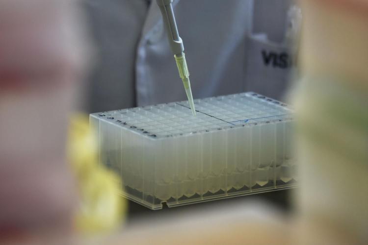 Pancreas: Nuovo farmaco aumenta sopravvivenza cancro metastatico